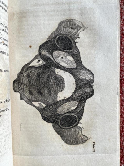 W. DEWEES Baudelocque's Midwifery 1811