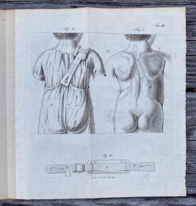 Johann JORG [1st Orthopedic textbook] Leipzig 1810