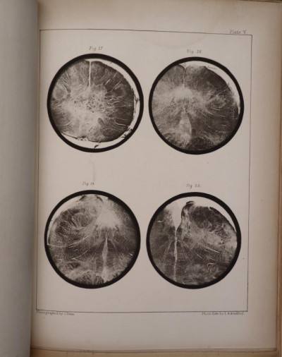 Image for Lot John Dean: Gray Substance (photoliths, 1864)