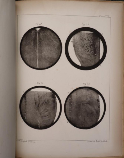 John Dean: Gray Substance (photoliths, 1864)