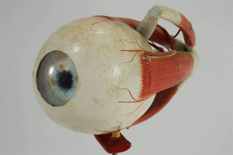 Clay Adams Anatomical Model of an Eye