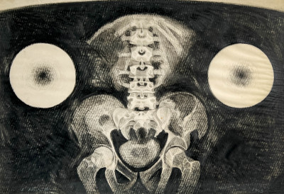 Lowell Nesbitt - Hip Bone and Spine