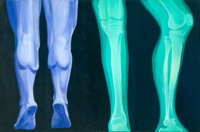 Title Lowell Nesbitt - Four Legs / Artist